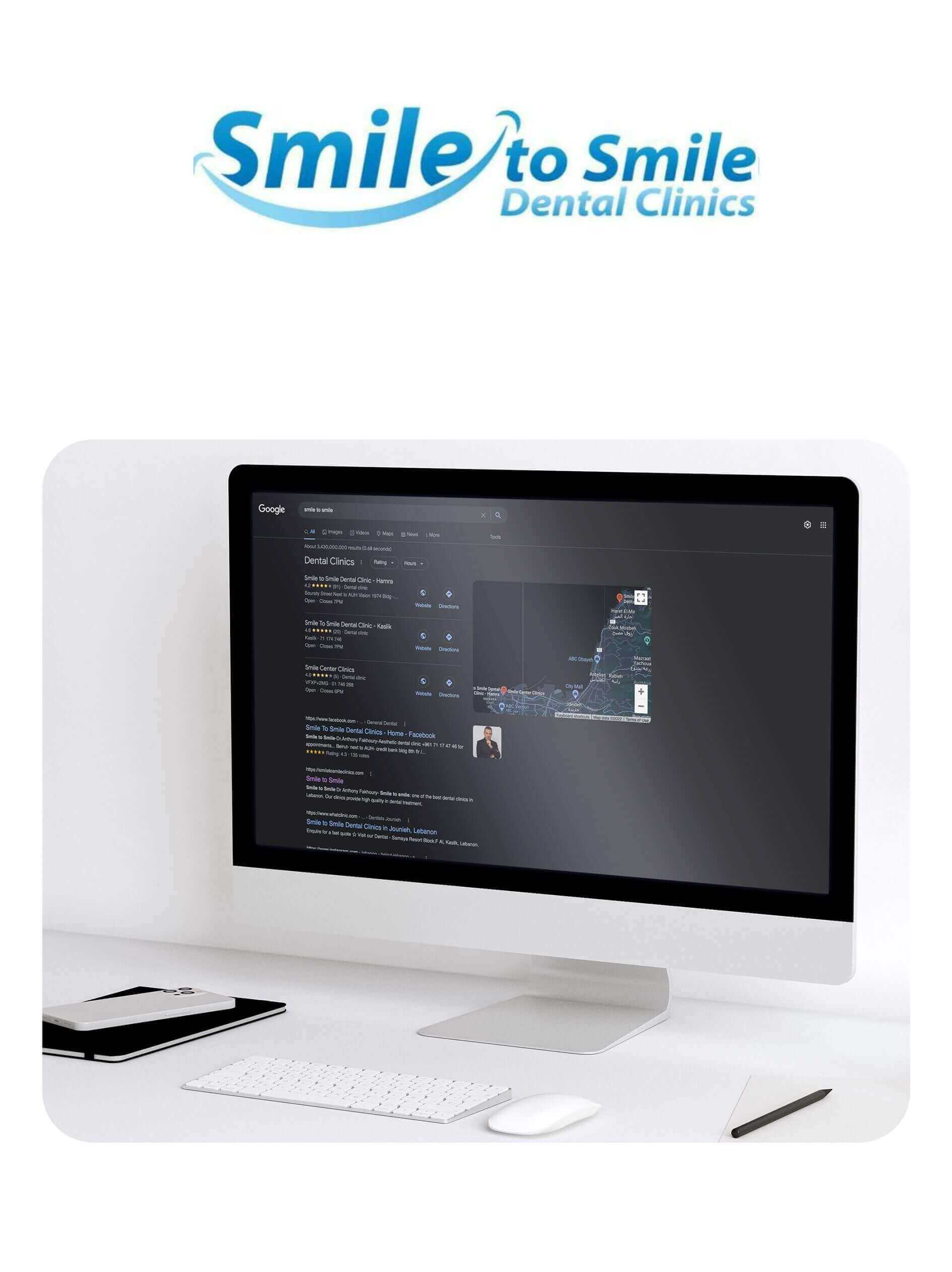 Ads management for Smile to smile